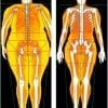 DEXA Scans with Body Map 360